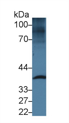 矢车菊苷α1(CENTa1)多克隆抗体