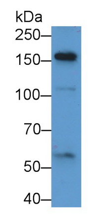 α2-巨球蛋白样蛋白1(a2ML1)多克隆抗体