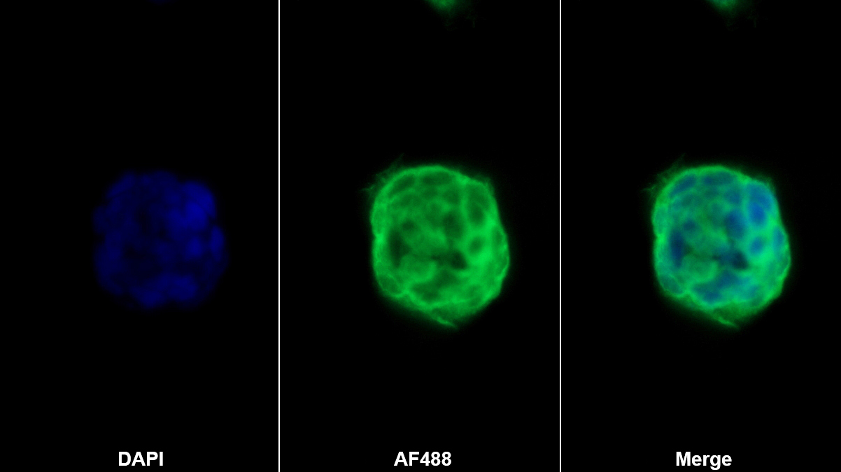 α2-巨球蛋白样蛋白1(a2ML1)多克隆抗体