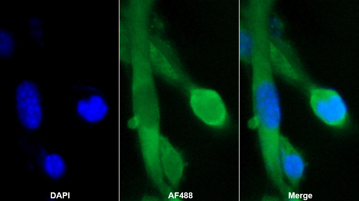 親環(huán)素A(CYPA)多克隆抗體