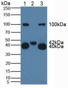 CD161分子(CD161)多克隆抗體
