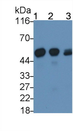 細(xì)胞色素P450家族成員2E1(CYP2E1)多克隆抗體