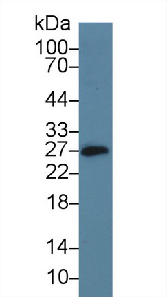 CD160分子(CD160)多克隆抗體