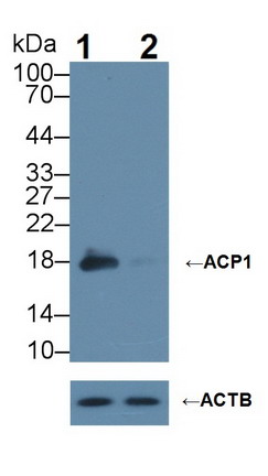 酸性磷酸酶1(ACP1)多克隆抗體