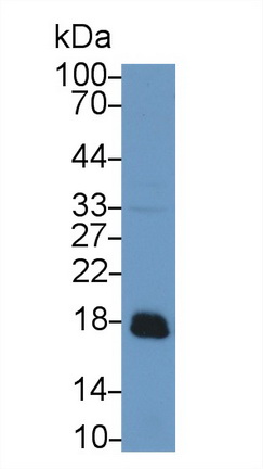 酸性磷酸酶1(ACP1)多克隆抗體
