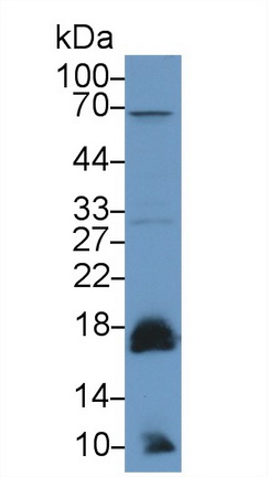 酸性磷酸酶1(ACP1)多克隆抗體