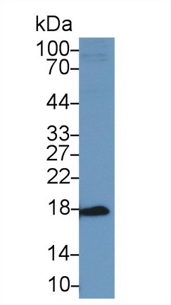 酸性磷酸酶1(ACP1)多克隆抗體