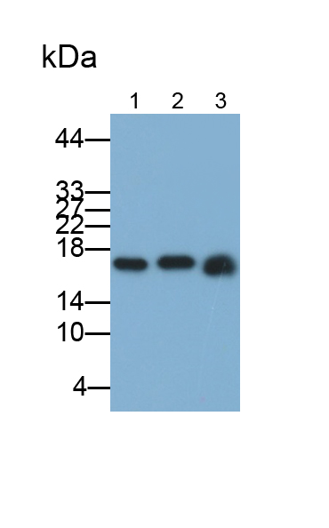 酸性磷酸酶1(ACP1)多克隆抗體