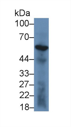 血管生成素樣蛋白4(ANGPTL4)多克隆抗體