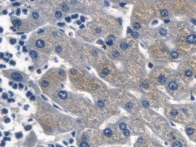连环蛋白β1(β-catenin)多克隆抗体