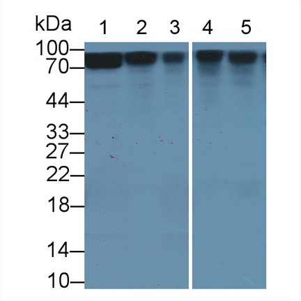 连环蛋白β1(β-catenin)多克隆抗体