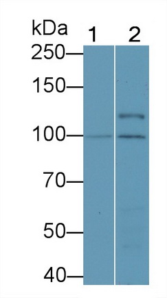 連環(huán)蛋白β1(β-catenin)多克隆抗體