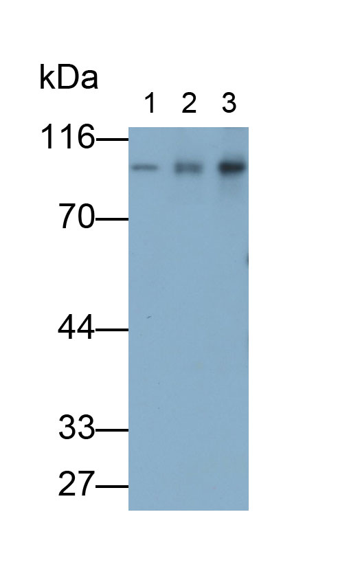 連環(huán)蛋白β1(β-catenin)多克隆抗體