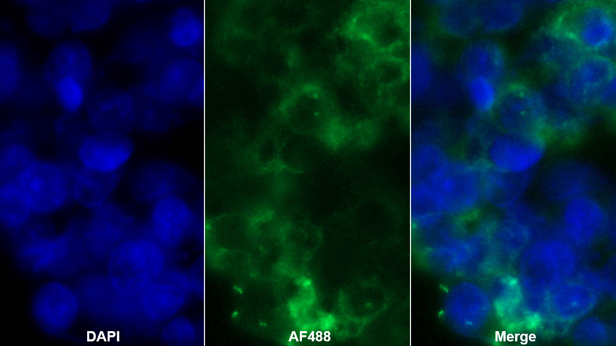 白蛋白(ALB)多克隆抗體