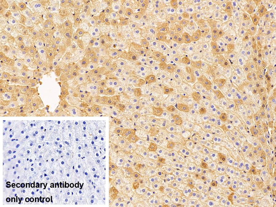白蛋白(ALB)多克隆抗體