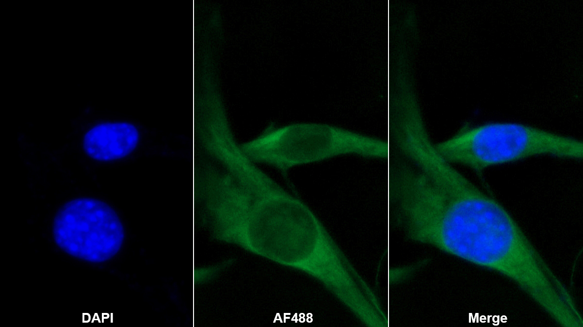 玻連蛋白(VTN)多克隆抗體