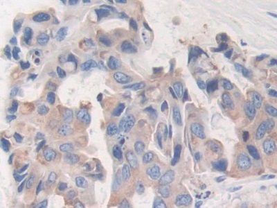 CD15分子(CD15)多克隆抗體