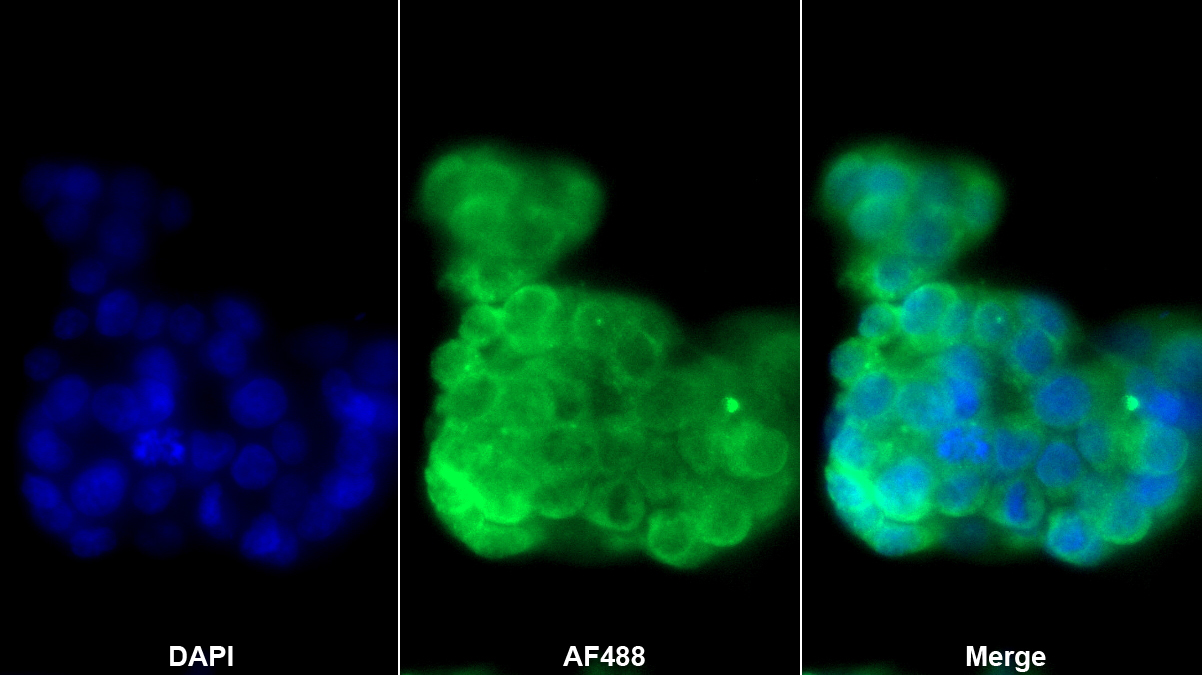 70kDa熱休克蛋白1樣蛋白(HSPA1L)多克隆抗體