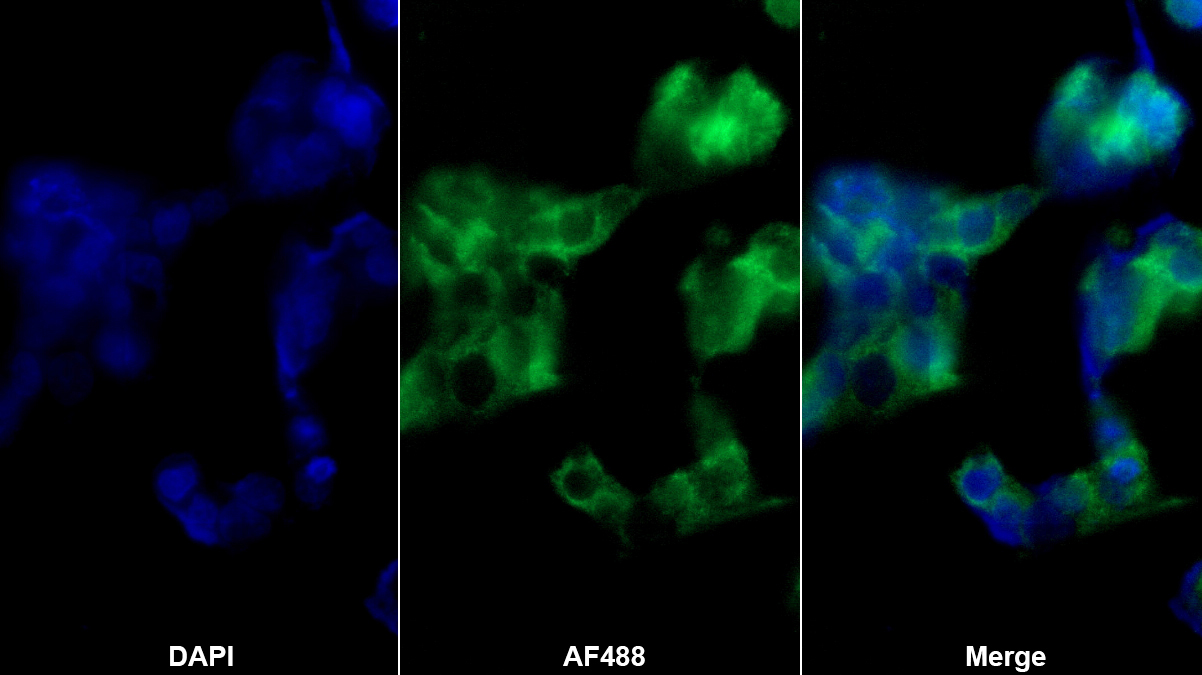 类胰蛋白酶(TPS)多克隆抗体