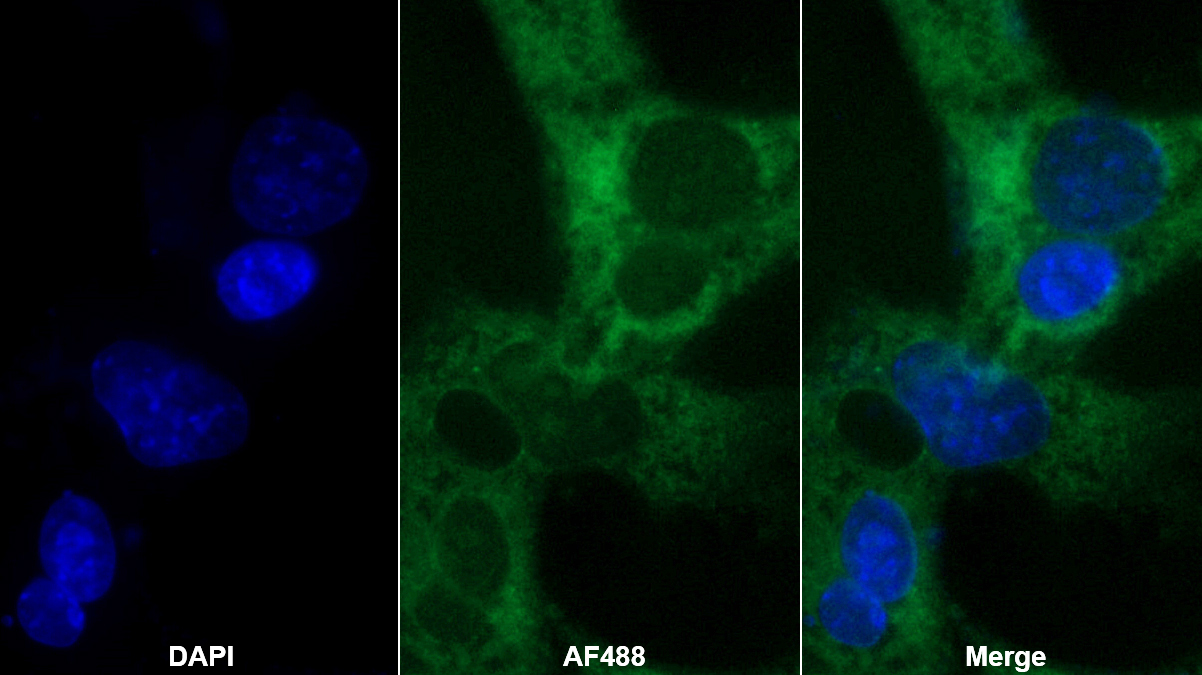 類胰蛋白酶(TPS)多克隆抗體