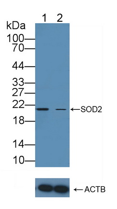 线粒体超氧化物歧化酶(SOD2)多克隆抗体