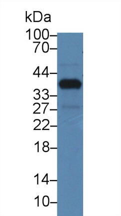37kDa核孔蛋白(NUP37)多克隆抗体