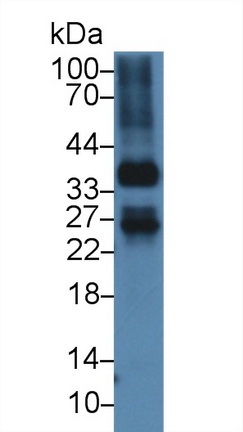 37kDa核孔蛋白(NUP37)多克隆抗体