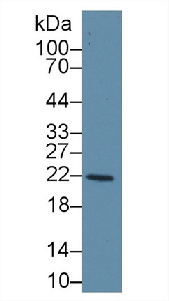 谷胱甘肽S转移酶κ1(GSTk1)多克隆抗体