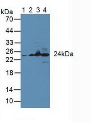 谷胱甘肽S转移酶κ1(GSTk1)多克隆抗体