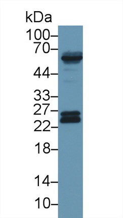 谷胱甘肽S轉(zhuǎn)移酶π1(GSTp)多克隆抗體