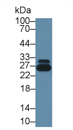 谷胱甘肽S转移酶π1(GSTp)多克隆抗体