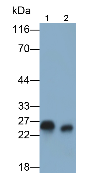 谷胱甘肽S轉移酶π1(GSTp)多克隆抗體