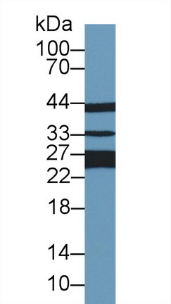 谷胱甘肽S转移酶π1(GSTp)多克隆抗体