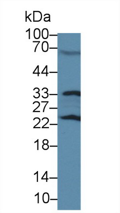 谷胱甘肽S轉(zhuǎn)移酶π1(GSTp)多克隆抗體