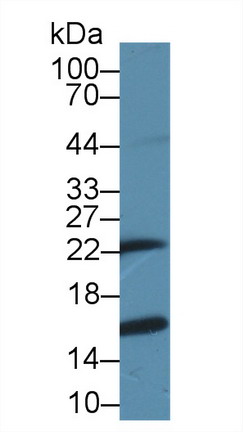 谷胱甘肽S轉(zhuǎn)移酶π1(GSTp)多克隆抗體
