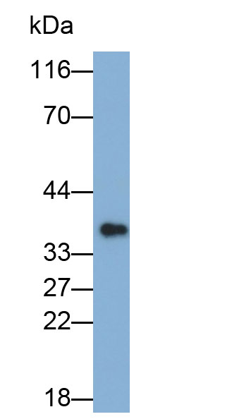 CD8a分子(CD8a)多克隆抗體