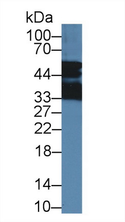 50kDa核孔蛋白(NUP50)多克隆抗體