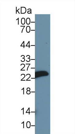 肌球蛋白轻链1(MYL1)多克隆抗体