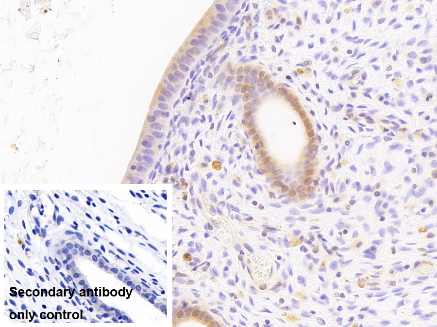 金屬硫蛋白1(MT1)多克隆抗體