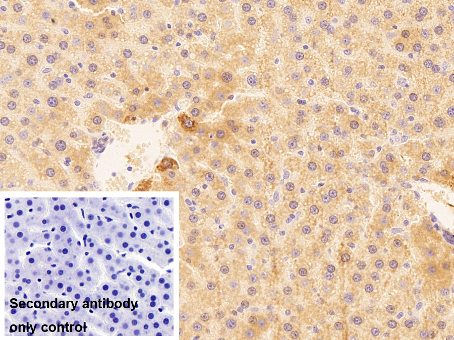 金屬硫蛋白1(MT1)多克隆抗體