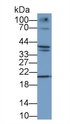 脱氧核糖核酸酶Ⅰ(DNASE1)多克隆抗体