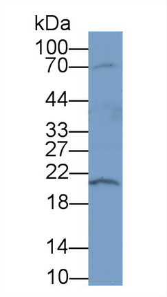 脱氧核糖核酸酶Ⅰ(DNASE1)多克隆抗体