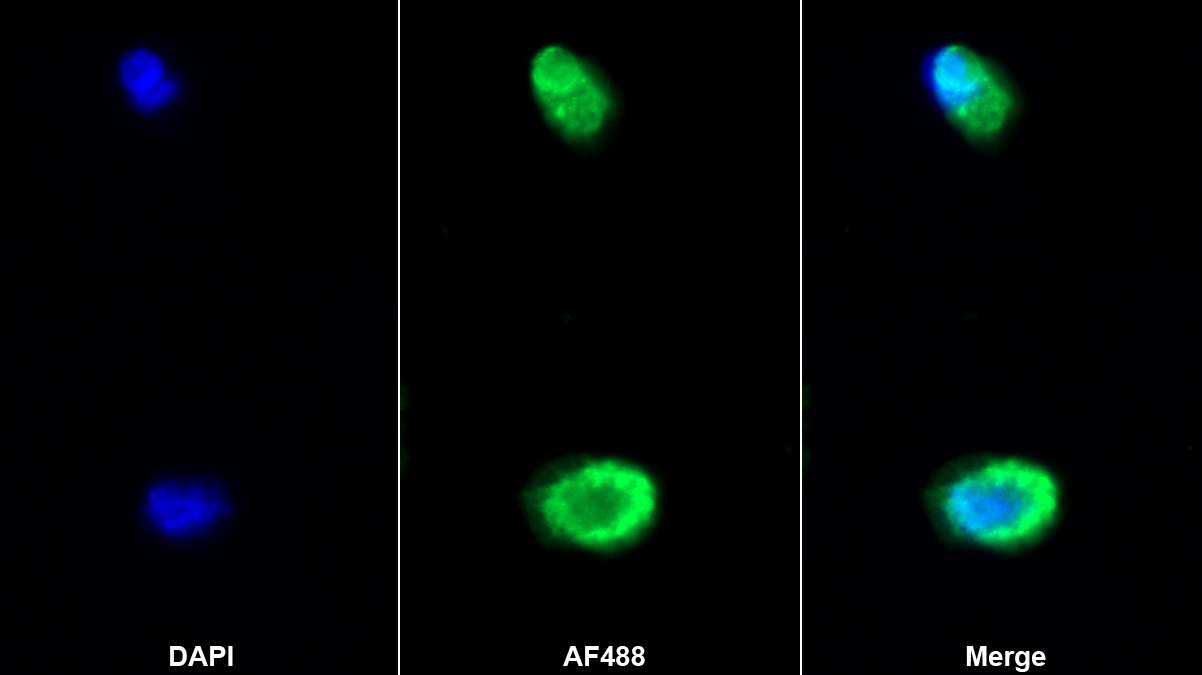 纖維蛋白原α(FGA)多克隆抗體