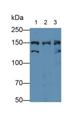 155kDa核孔蛋白(NUP155)多克隆抗体