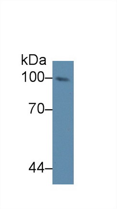 98kDa核孔蛋白(NUP98)多克隆抗体