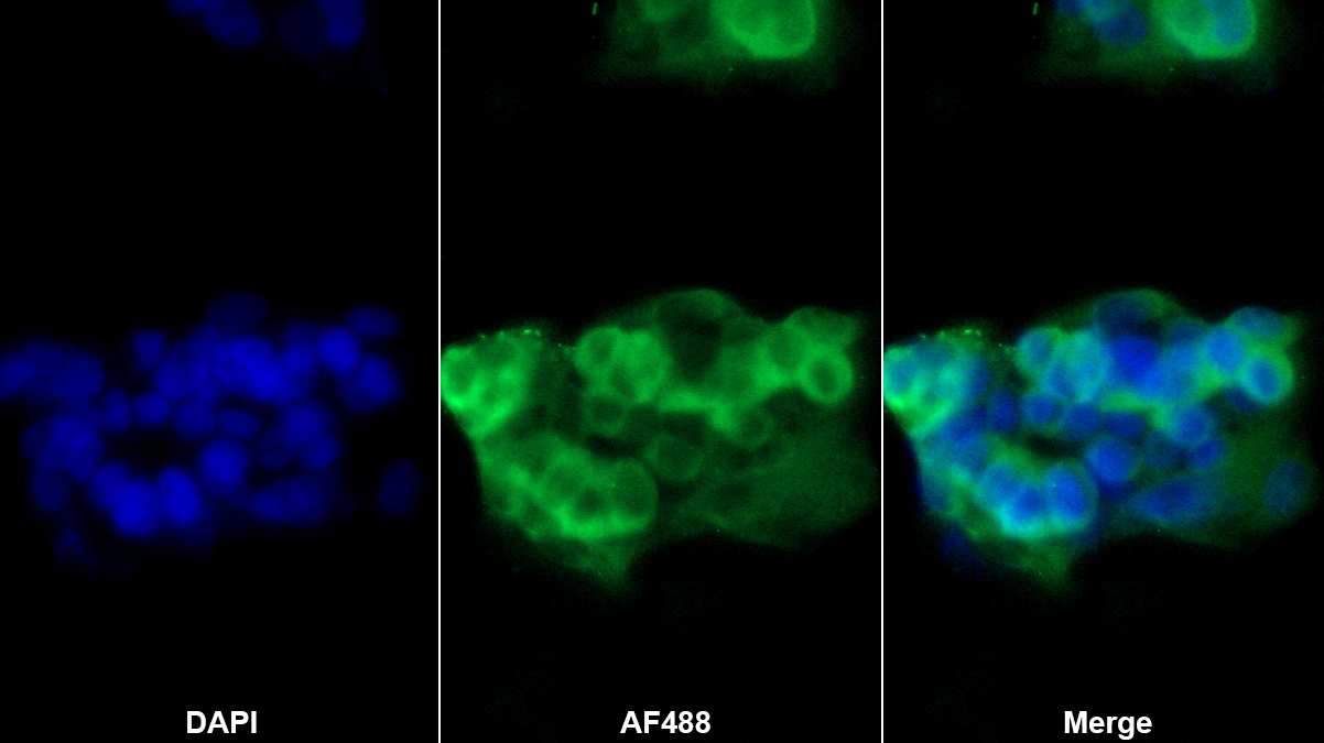 纤维蛋白原β(FGB)多克隆抗体