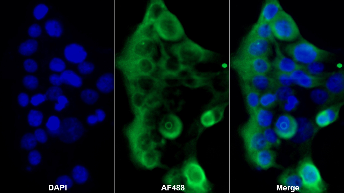 纤维蛋白原β(FGB)多克隆抗体