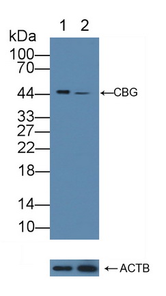 皮質(zhì)醇結(jié)合球蛋白(CBG)多克隆抗體