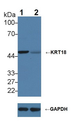 角蛋白18(CK18)多克隆抗體