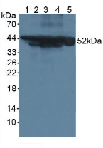 角蛋白18(CK18)多克隆抗體